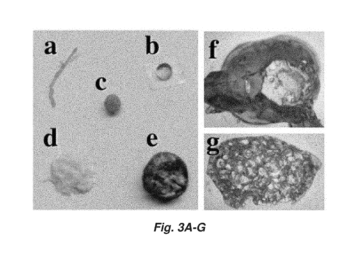 Reversible metallopolymer network