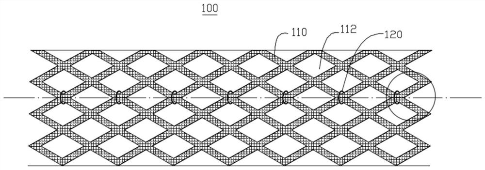 Pulmonary artery drug eluting stent and stent kit