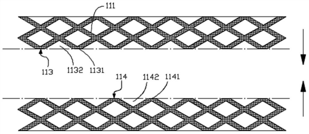 Pulmonary artery drug eluting stent and stent kit