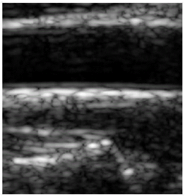 Carotid ultrasound image intima media thickness measurement method and system thereof