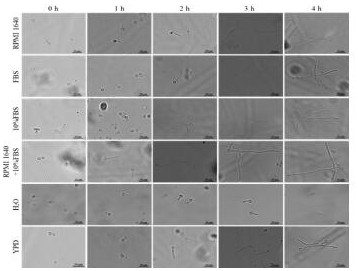 Method for screening hypha-state candida albicans virulence related genes