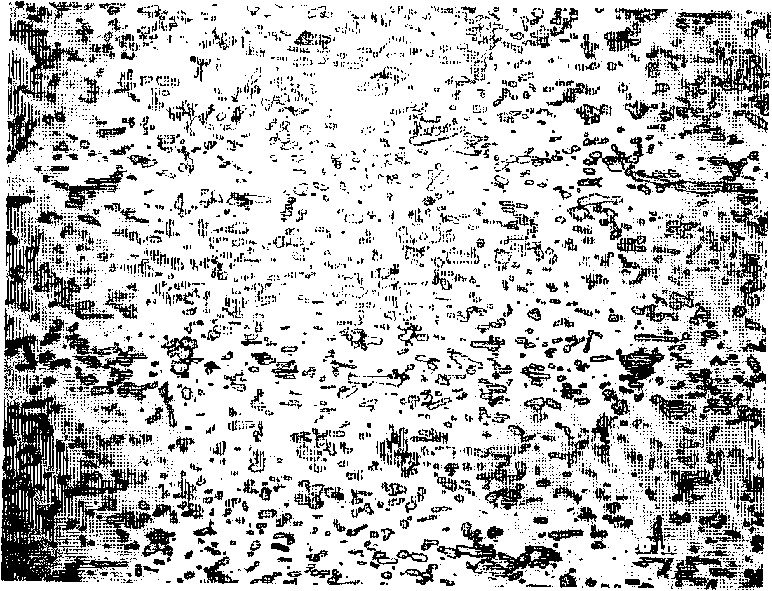 High boron content austenite stainless steel and preparation method thereof