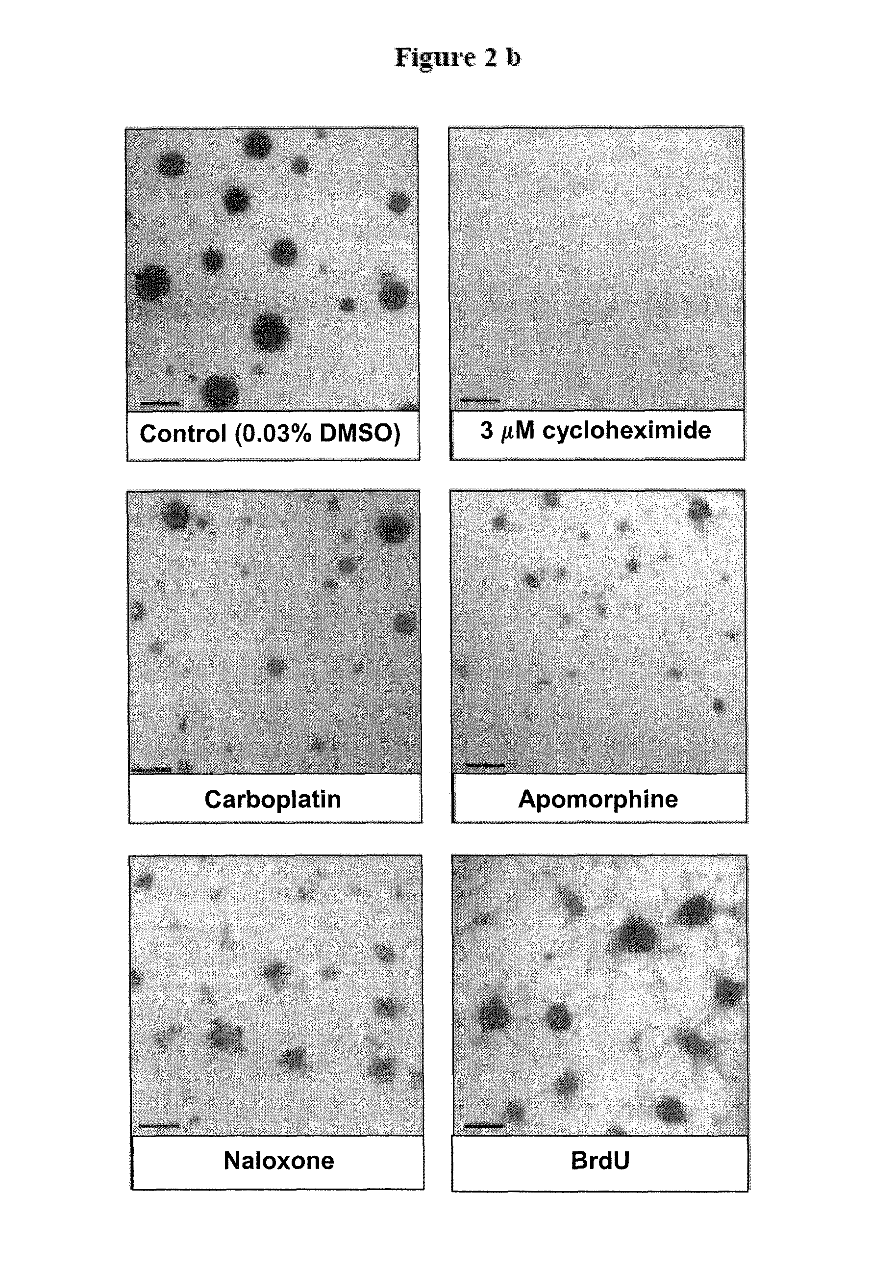 Method for treating a brain cancer with ifenprodil