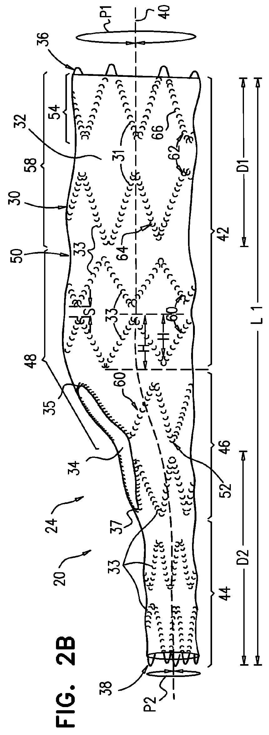 Multi-component stent-graft system for aortic dissections