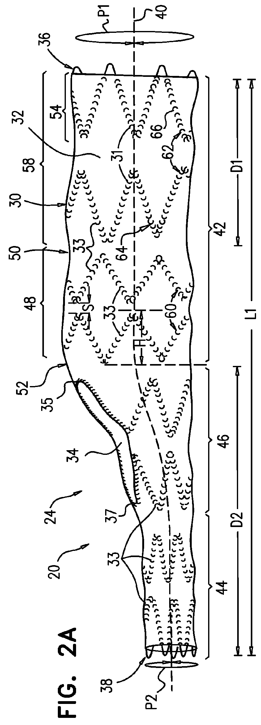 Multi-component stent-graft system for aortic dissections