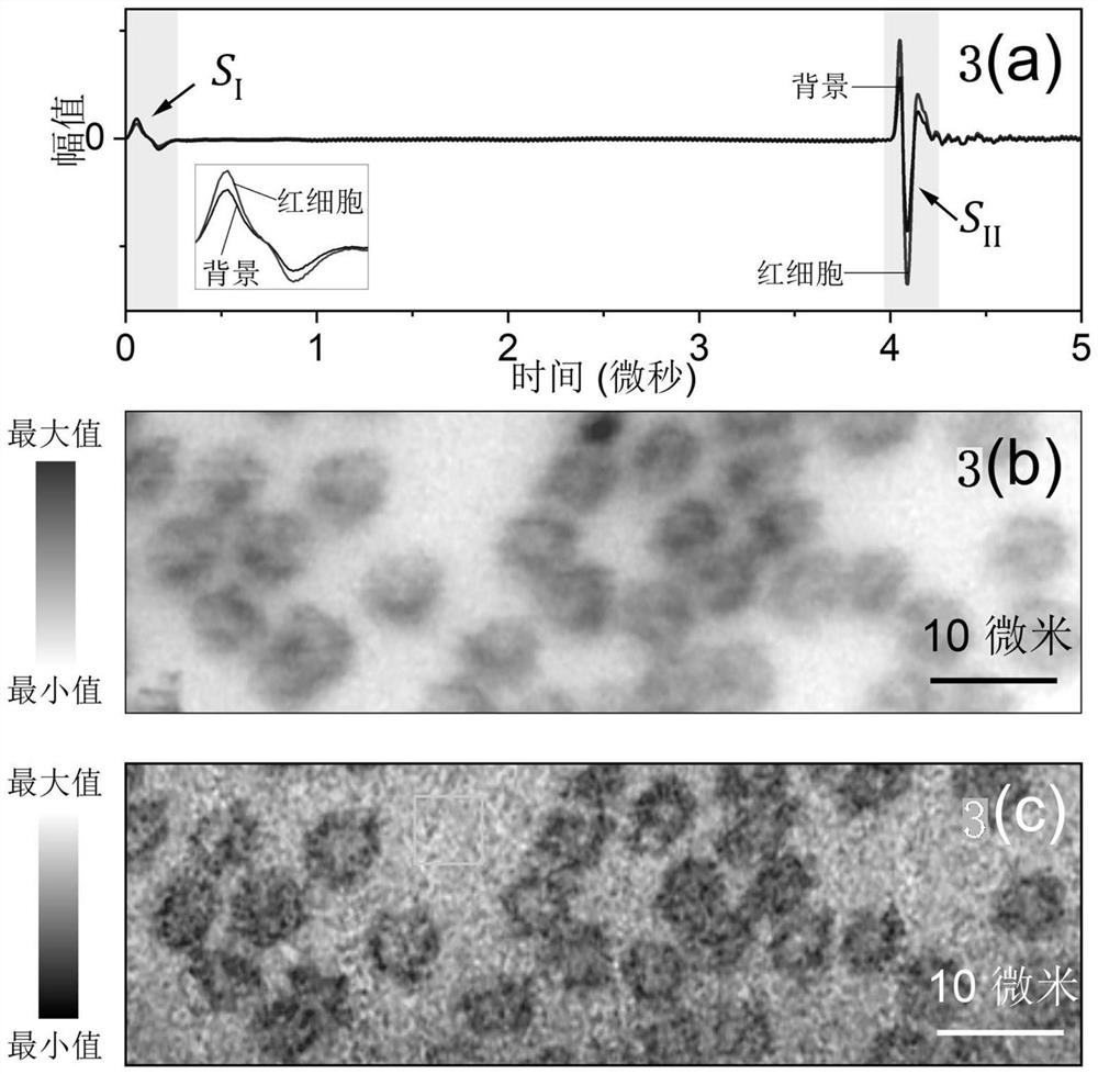 A Microscopic Imaging Method to Obtain Double Contrast of Light Absorption and Light Scattering Simultaneously