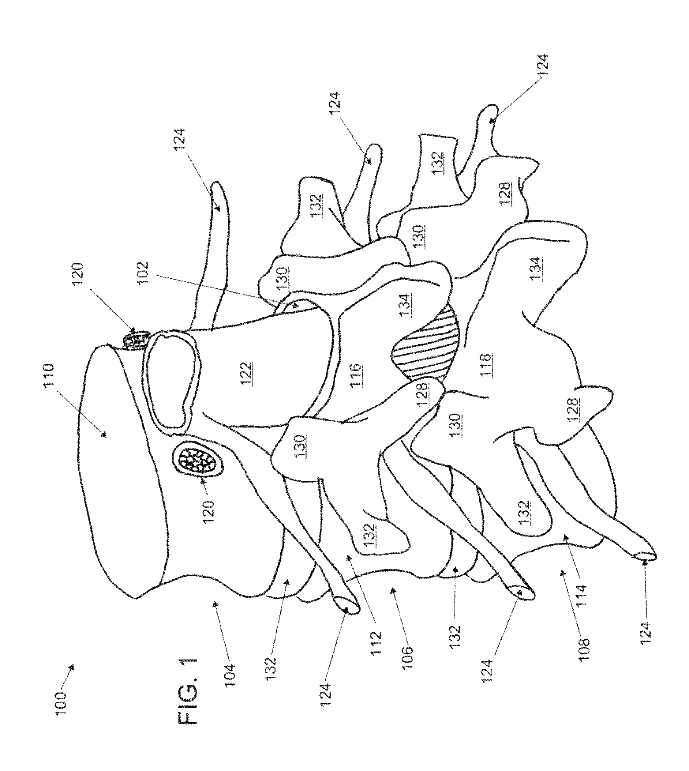 Systems and methods for cable-based tissue removal