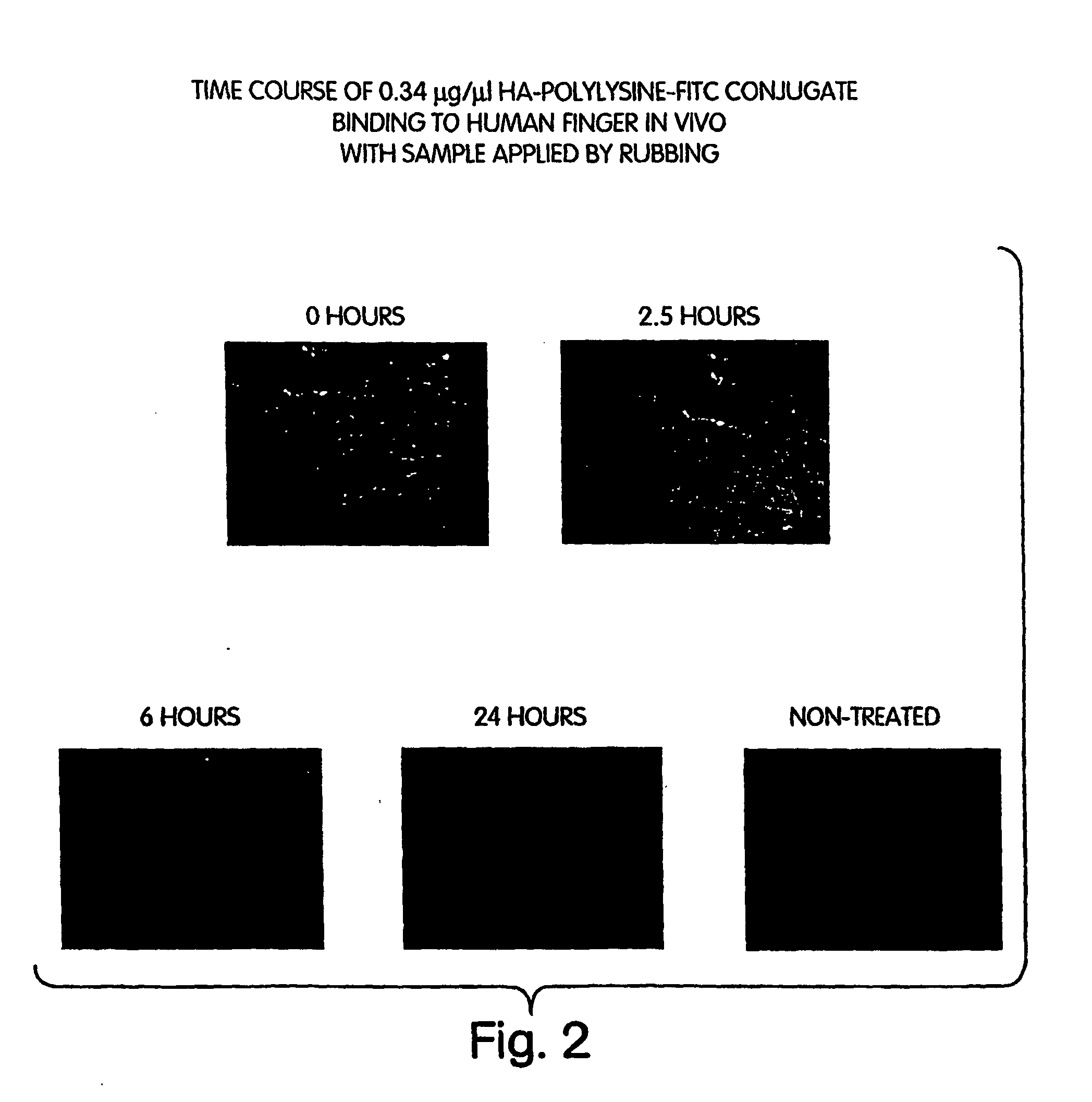 Compositions of hyaluronic acid and methods of use