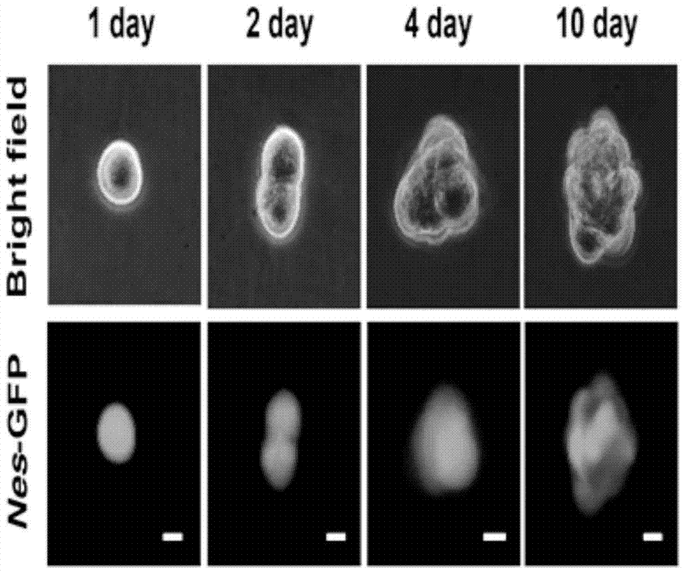 A method for isolating, culturing and using testicular mesenchymal stem cells expressing nestin