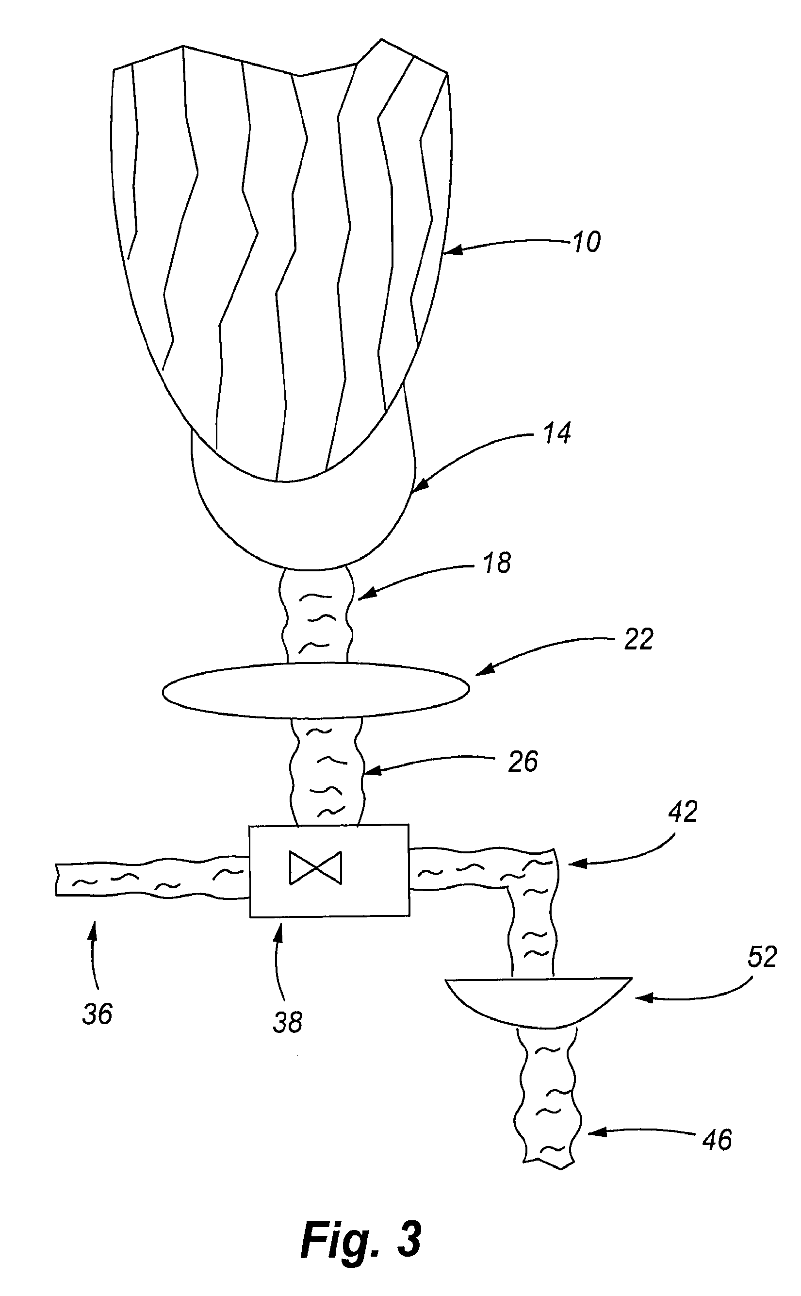 Method and system for processing glacial water