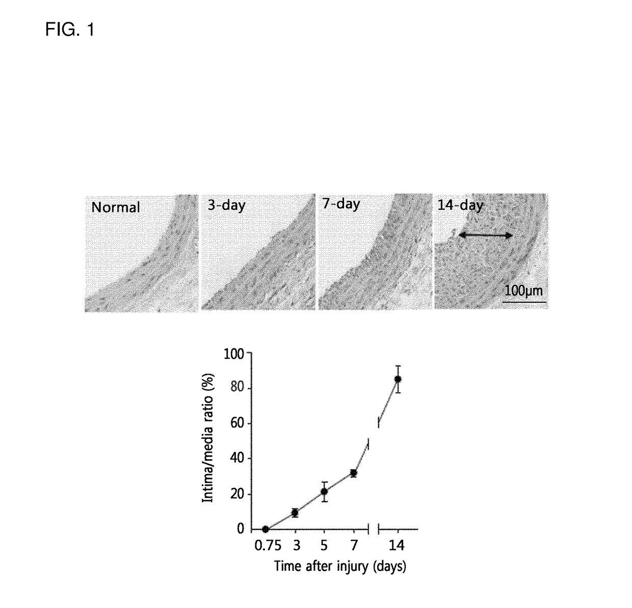 Biomarker for diagnosing vascular diseases and the uses thereof