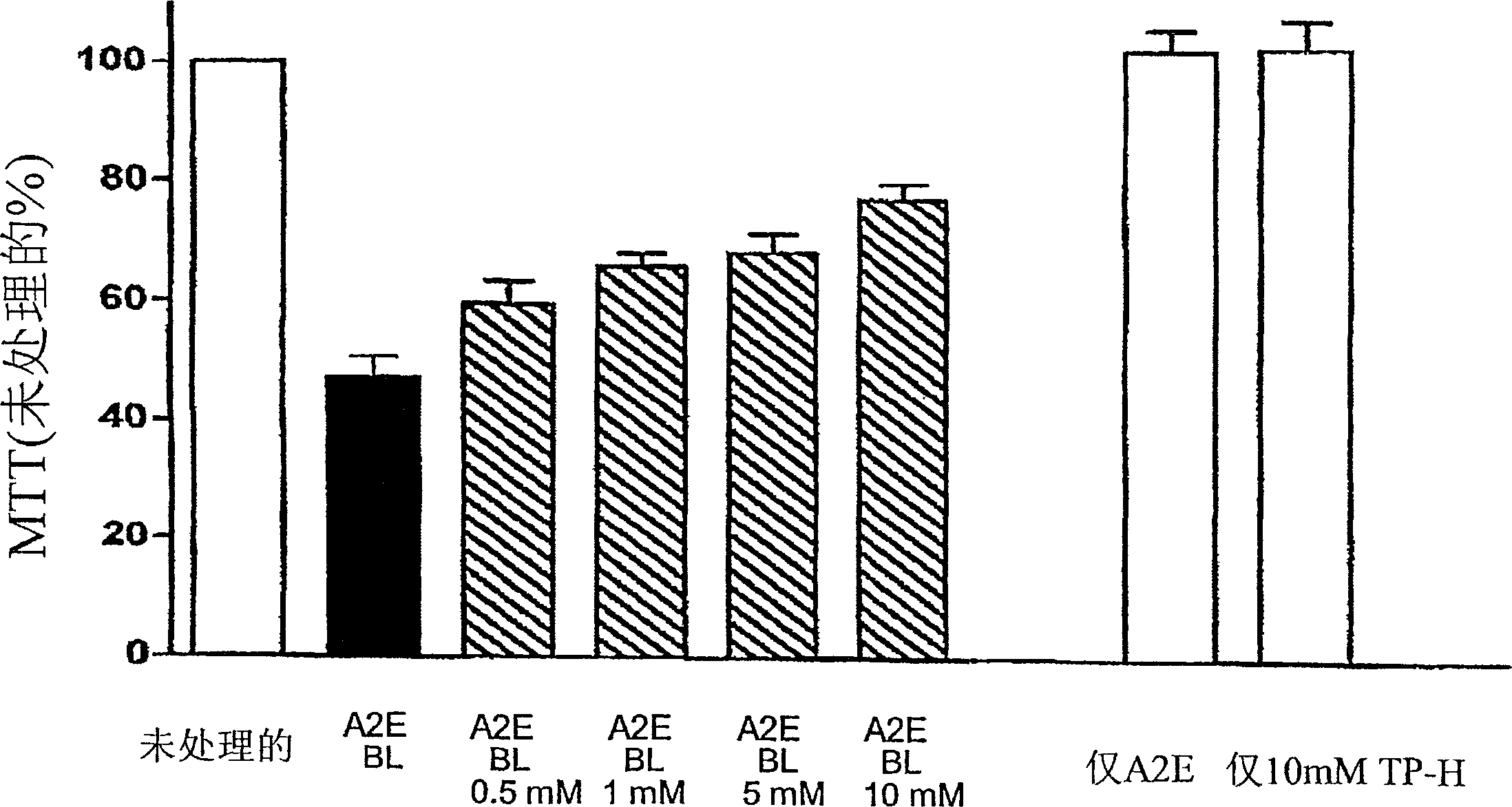 Amelioration of macular degeneration and other ophthalmic diseases