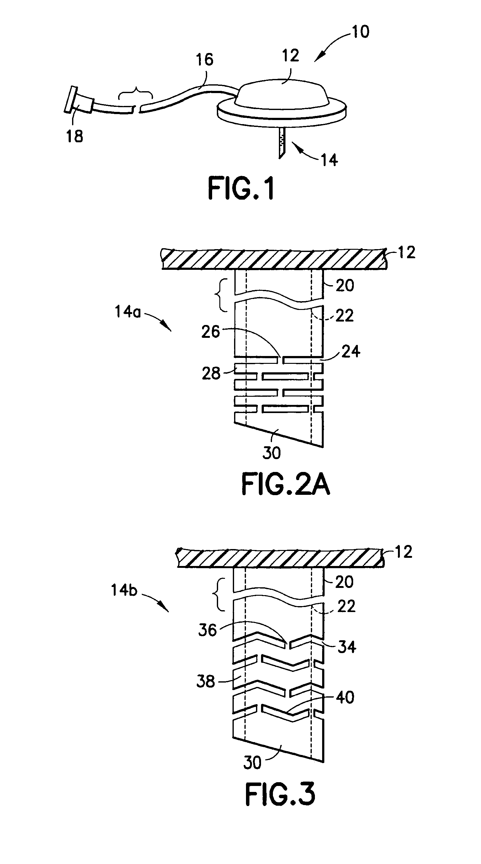 Infusion set and/or patch pump having at least one of an in-dwelling rigid catheter with flexible features and/or a flexible catheter attachment