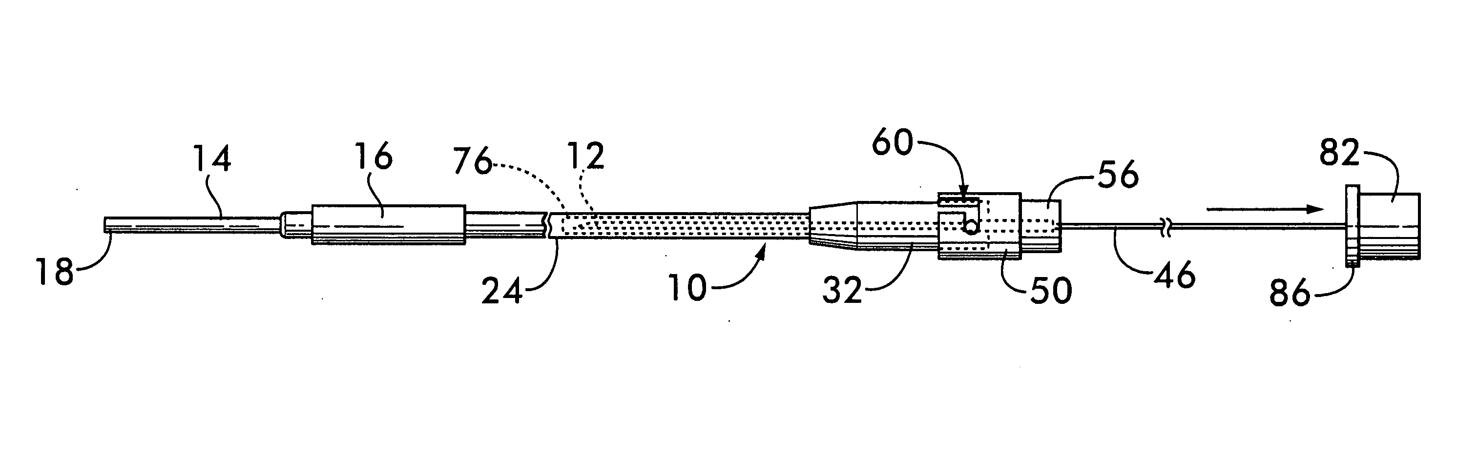 Safety intravenous starter