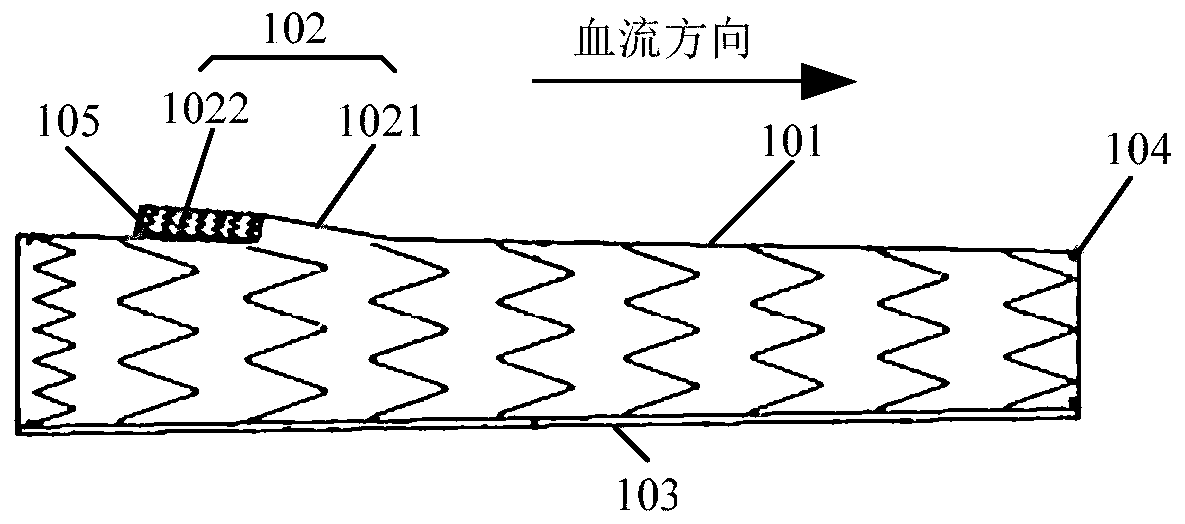 Covered stent system