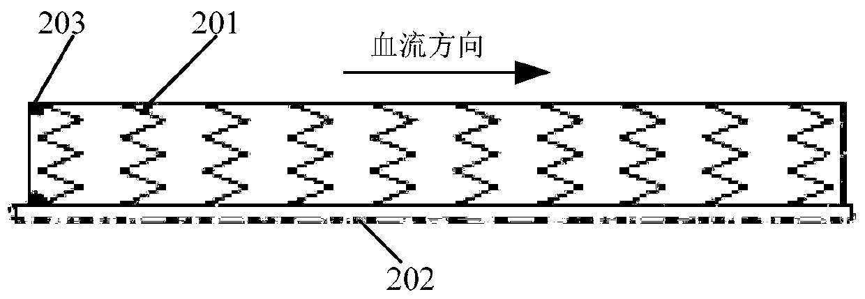 Covered stent system