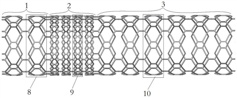 Iliac vein stent