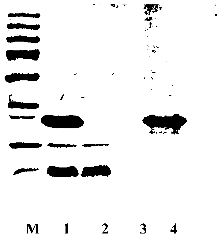 Use of nerve excitability injury-related polypeptide in preventing, alleviating or treating pain