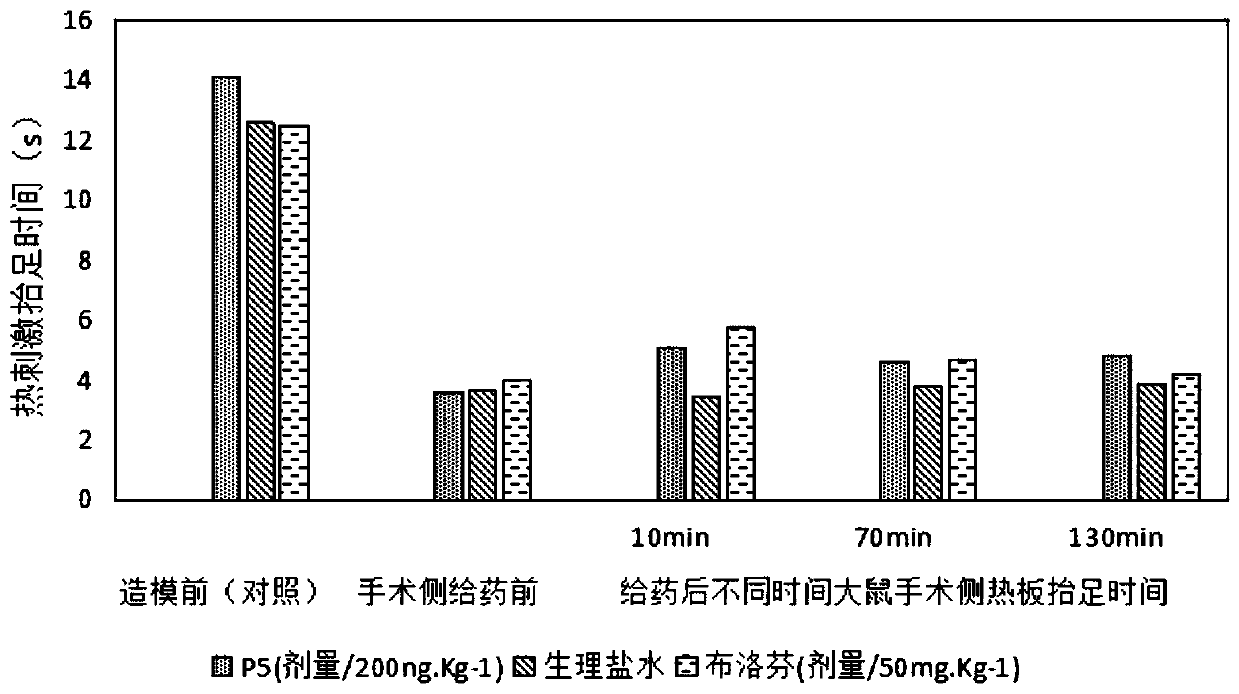 Use of nerve excitability injury-related polypeptide in preventing, alleviating or treating pain