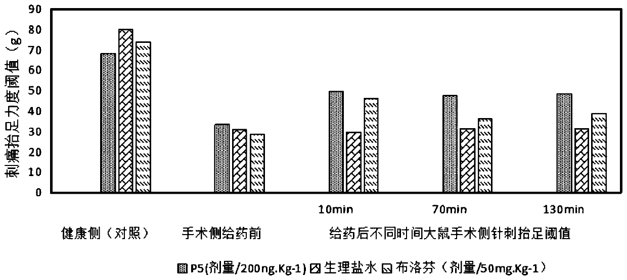 Use of nerve excitability injury-related polypeptide in preventing, alleviating or treating pain