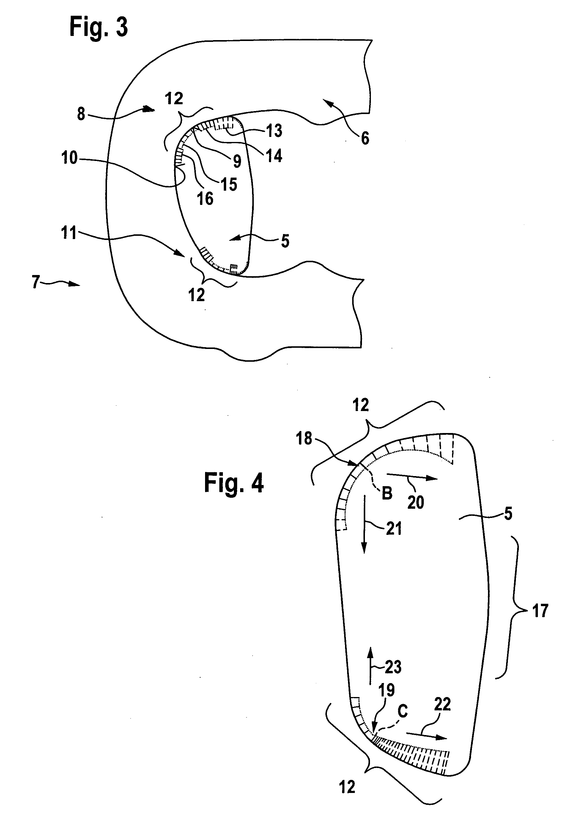 Link plate for a plate-link chain