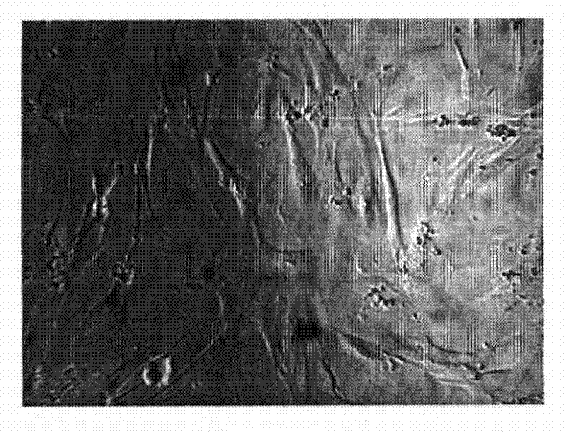 Composite of breviscapinum and panax notoginseng saponins Rg1 for treating pulmonary fibrosis and application thereof