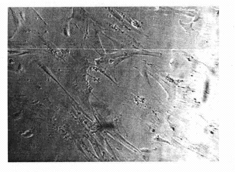 Composite of breviscapinum and panax notoginseng saponins Rg1 for treating pulmonary fibrosis and application thereof