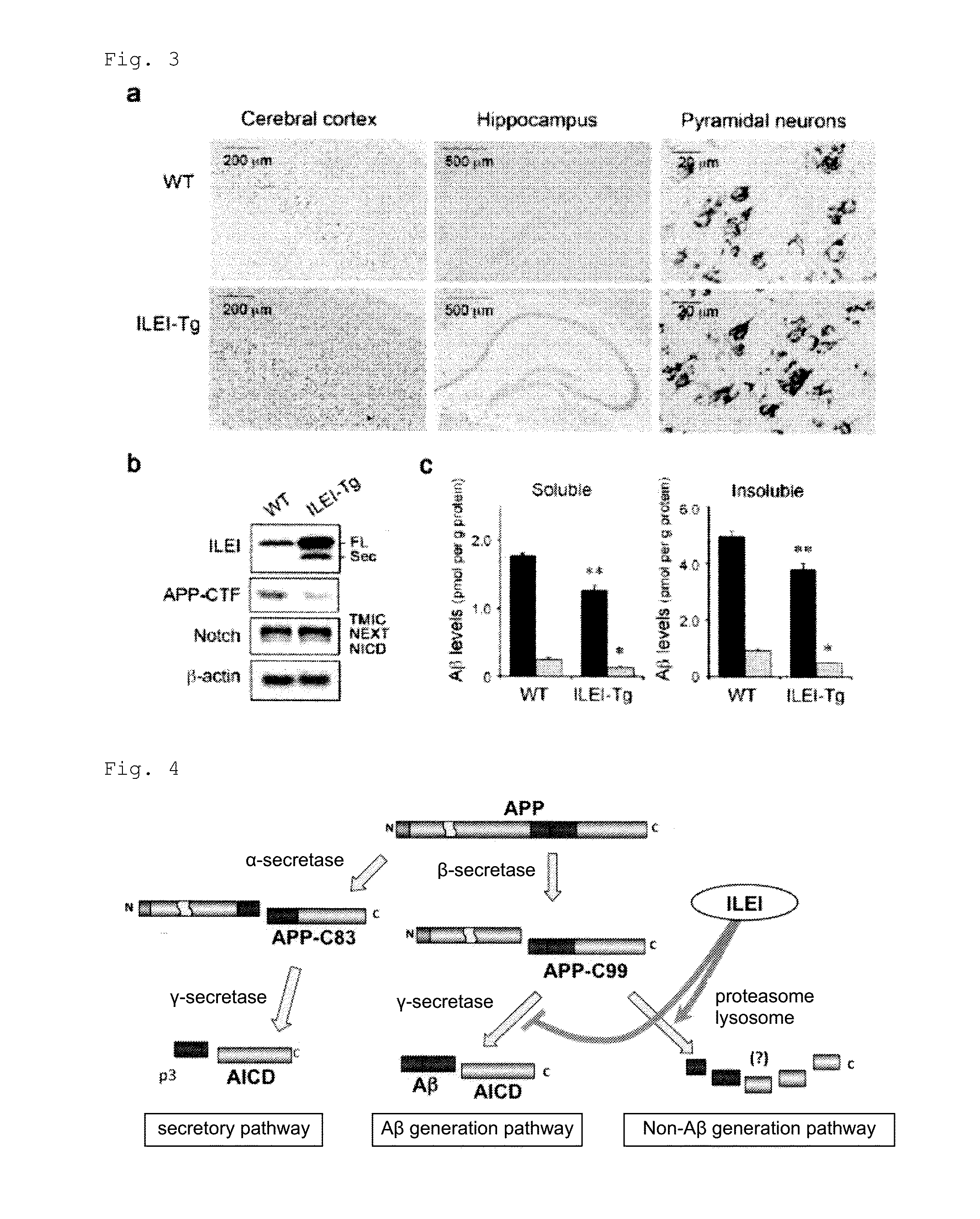 Pharmaceutical composition for the treatment and/or prevention of disease involving abnormal accumulation of amyloid beta protein