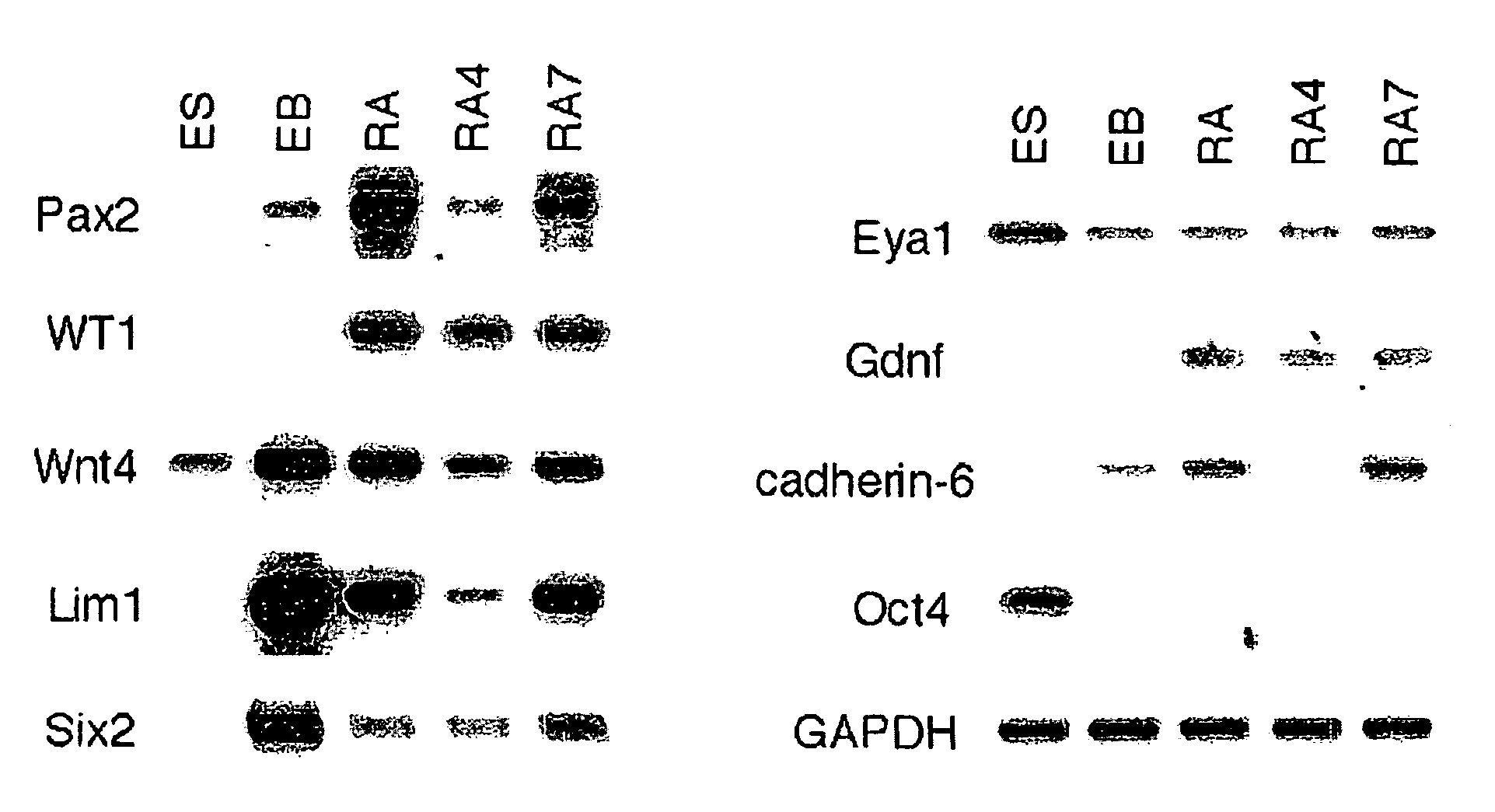 Renal progenitor cells from embryonic stem cells