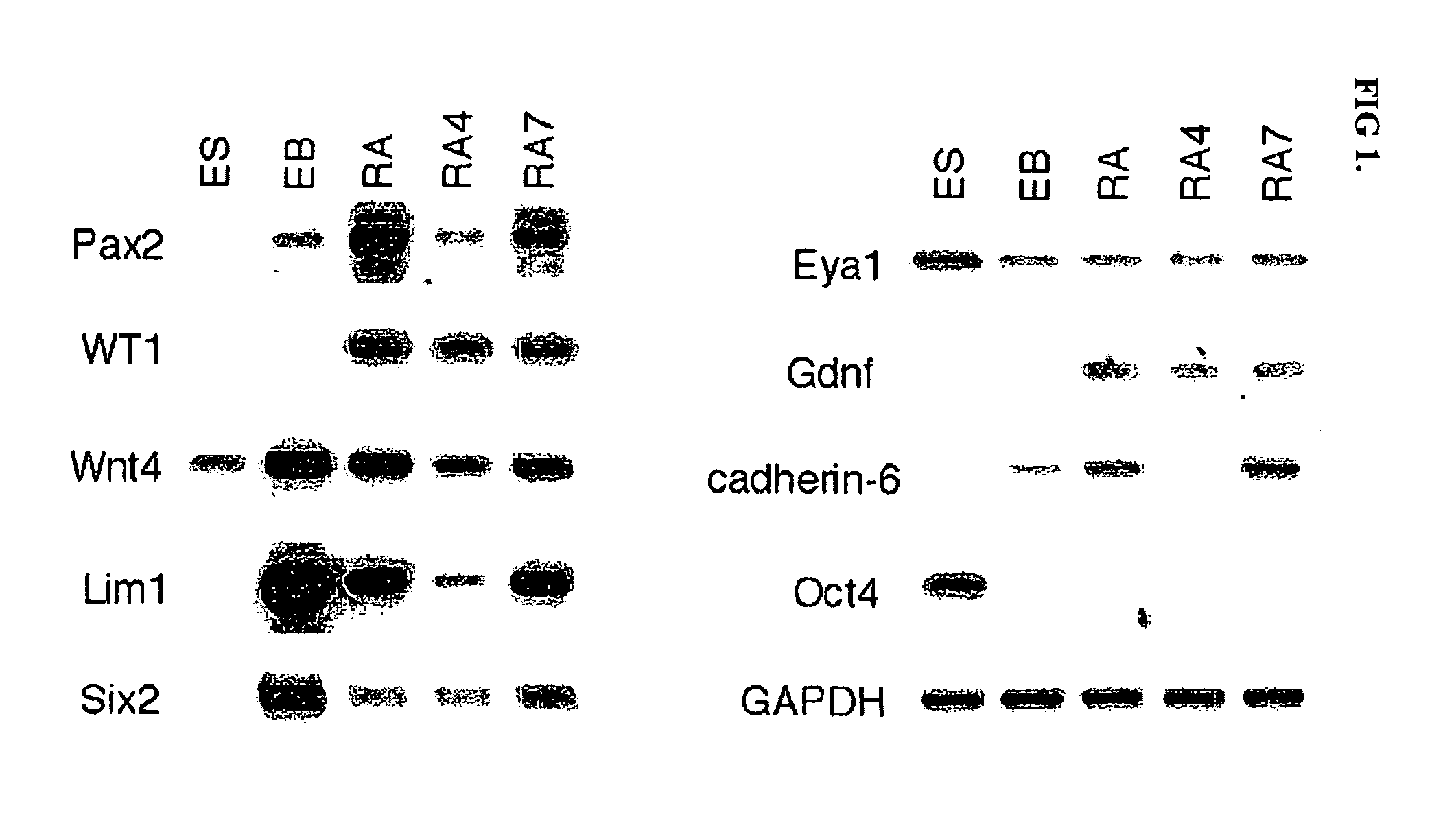 Renal progenitor cells from embryonic stem cells