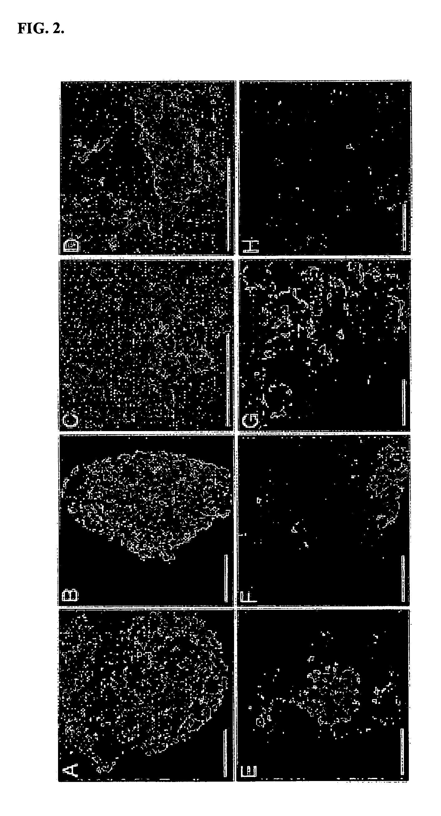 Renal progenitor cells from embryonic stem cells