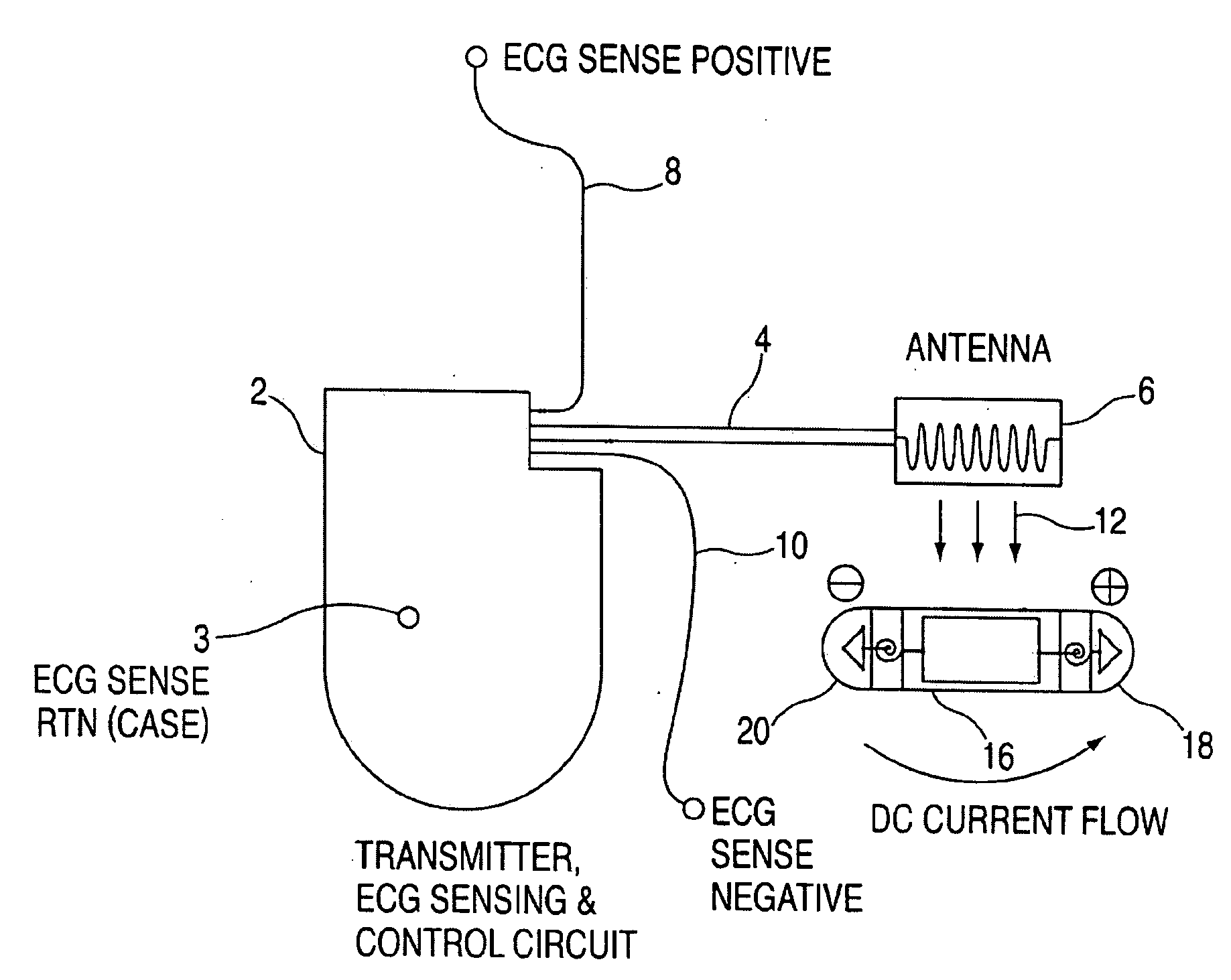 Apparatus and method for treating atrial fibrillation and atrial tachycardia