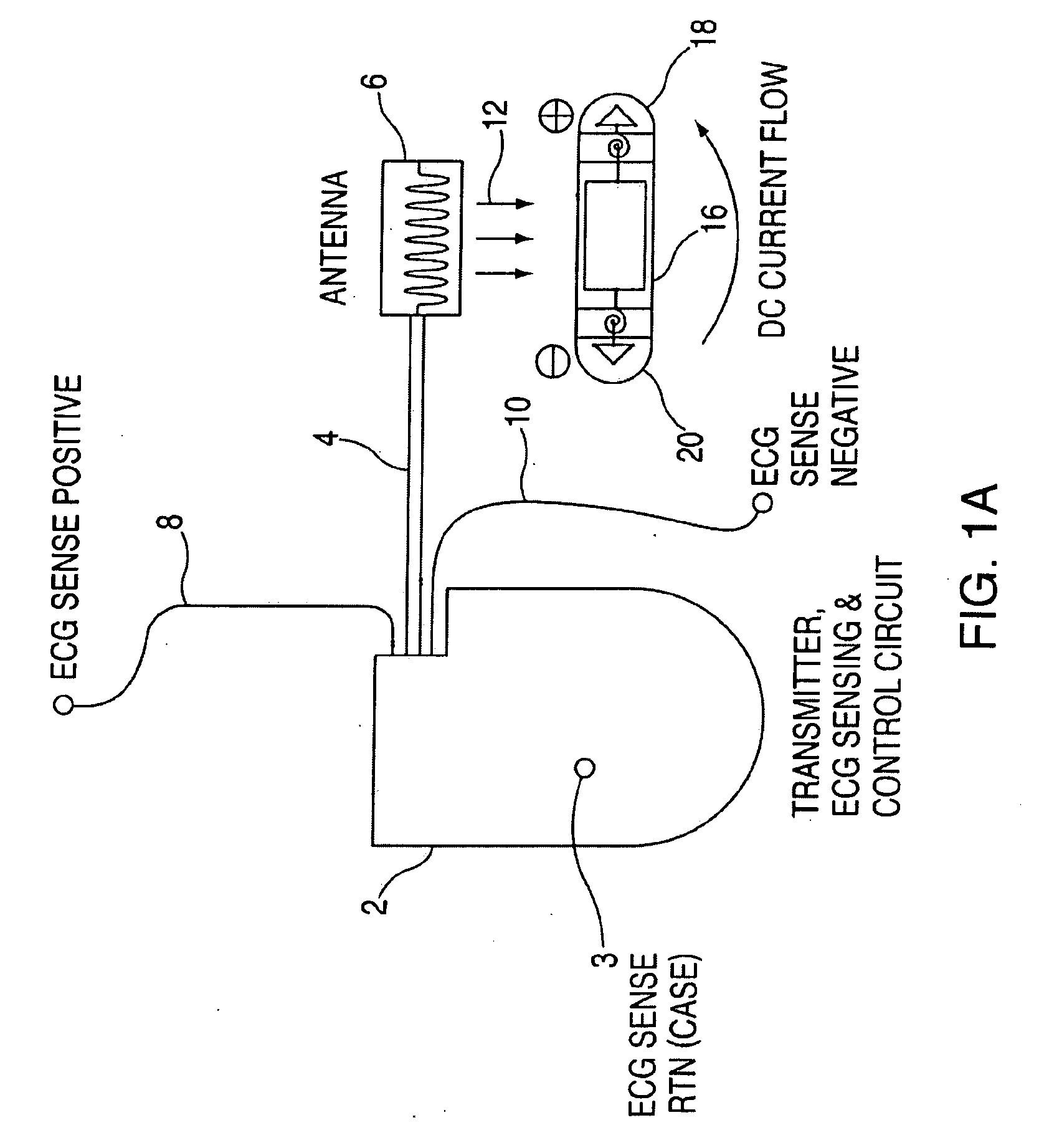 Apparatus and method for treating atrial fibrillation and atrial tachycardia