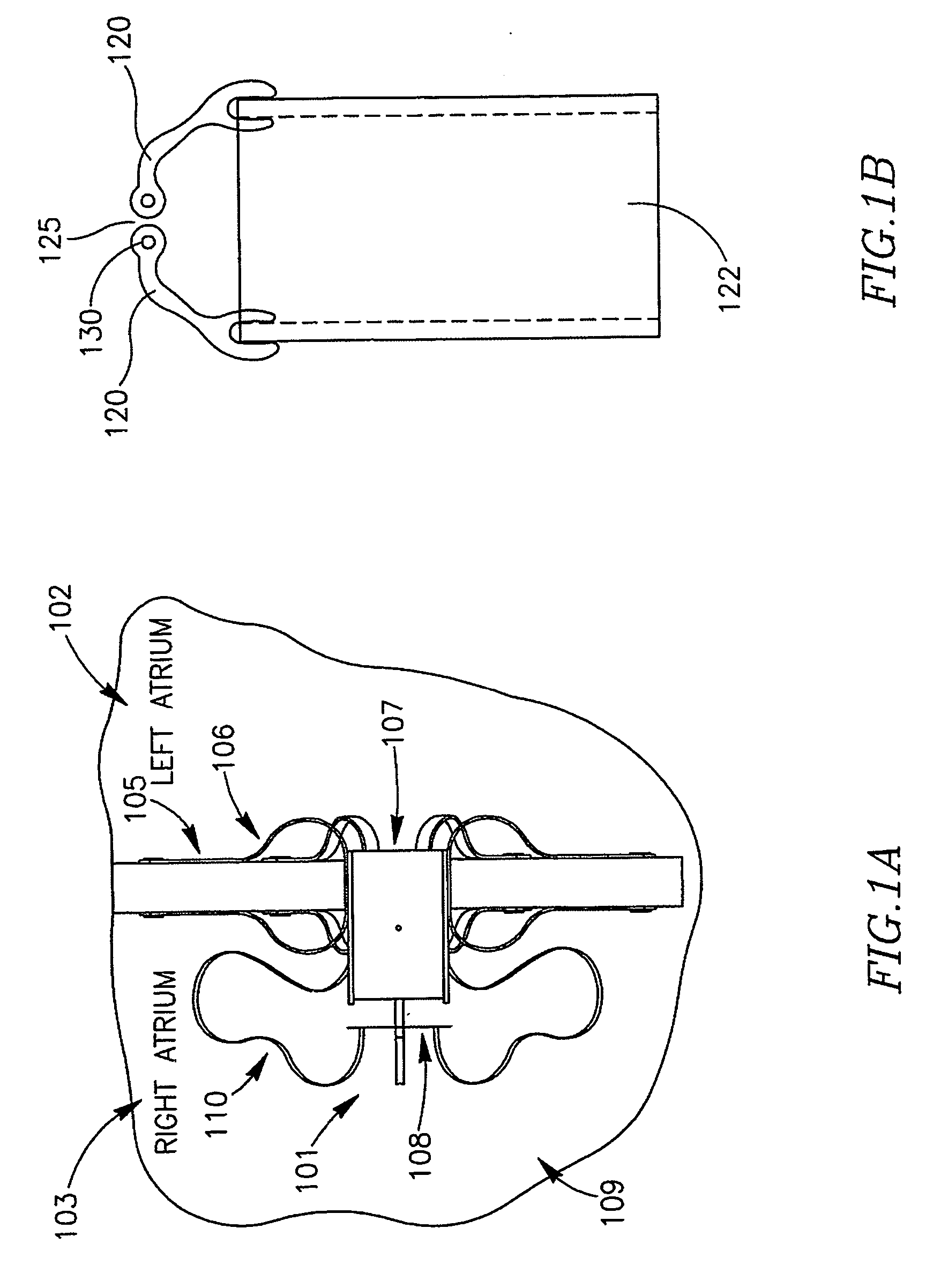 Device and method for controlling in-vivo pressure