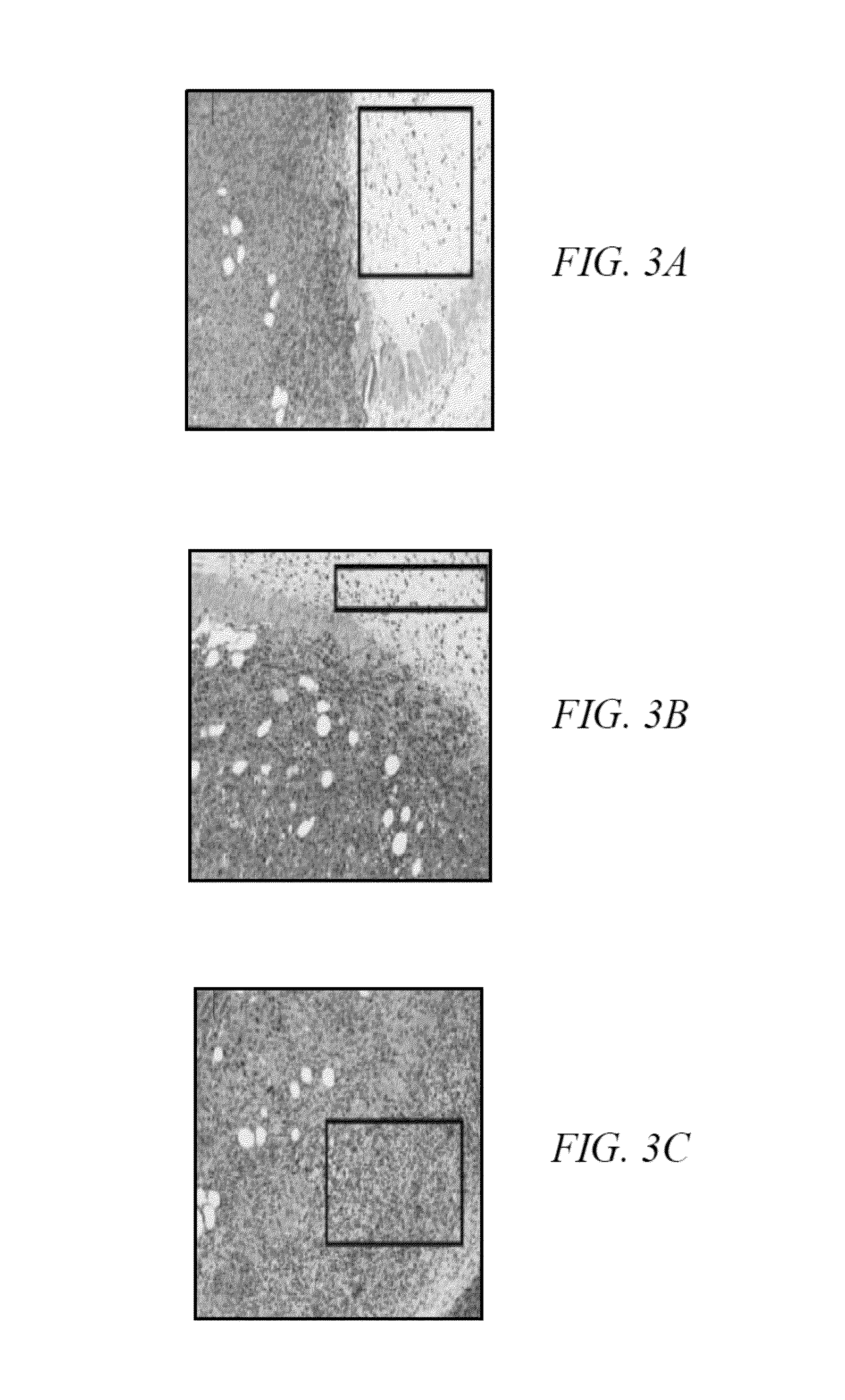 Method for the treatment of malignancies