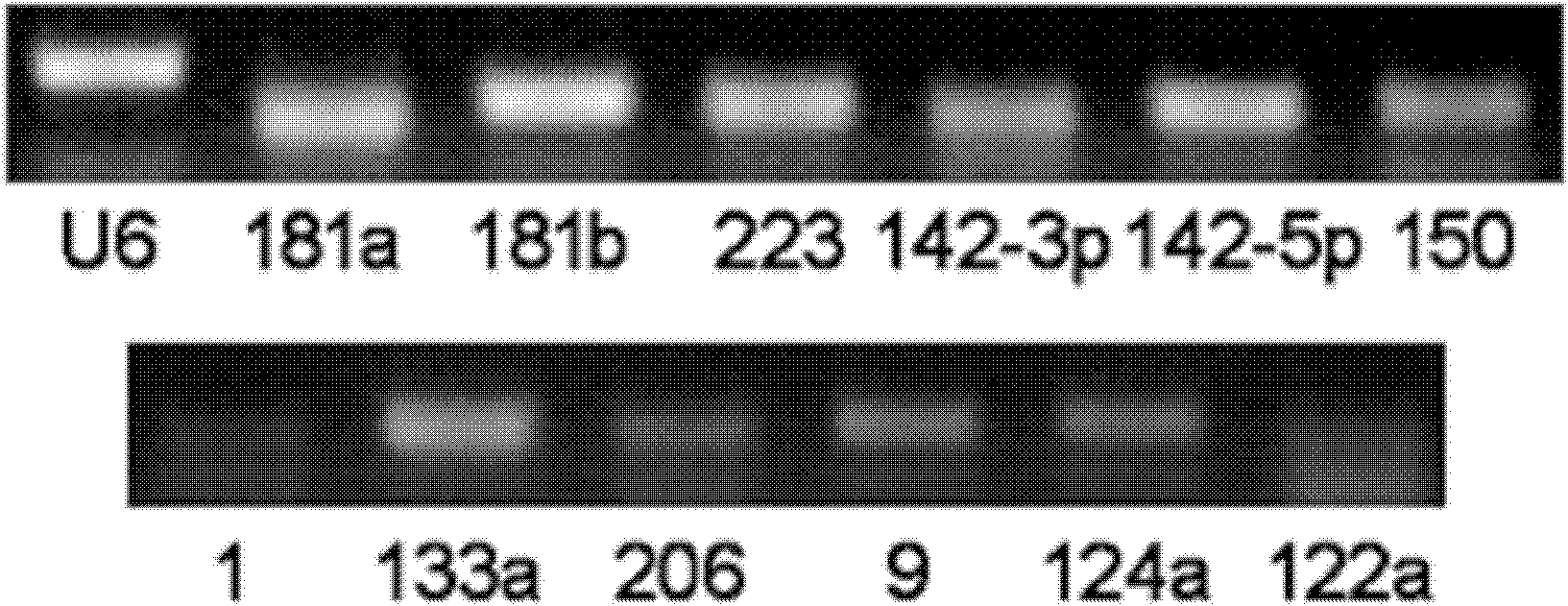 Cervical cancer detection markers and detection method, kit and biochip thereof