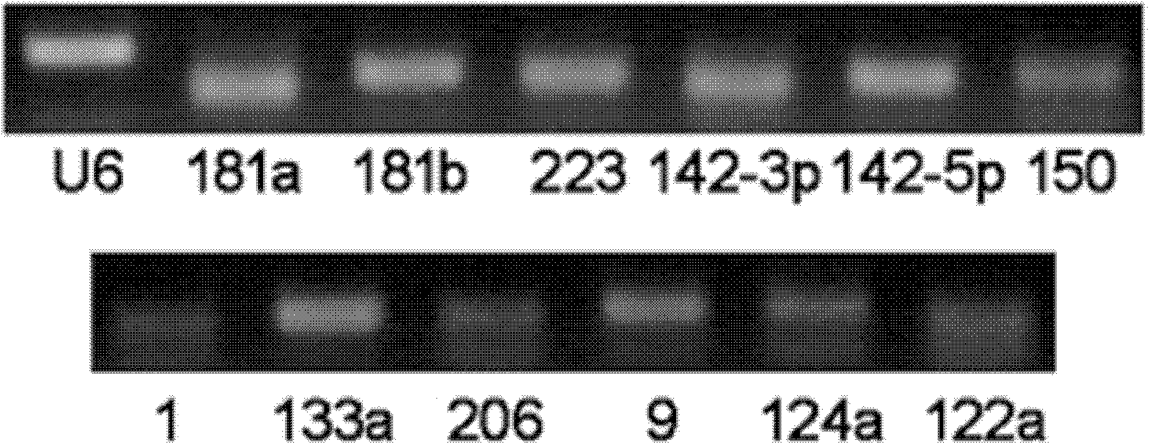 Cervical cancer detection markers and detection method, kit and biochip thereof