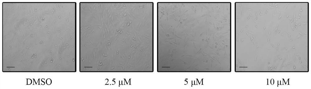 Application of cynanoside H in the preparation of drugs for preventing and treating breast cancer