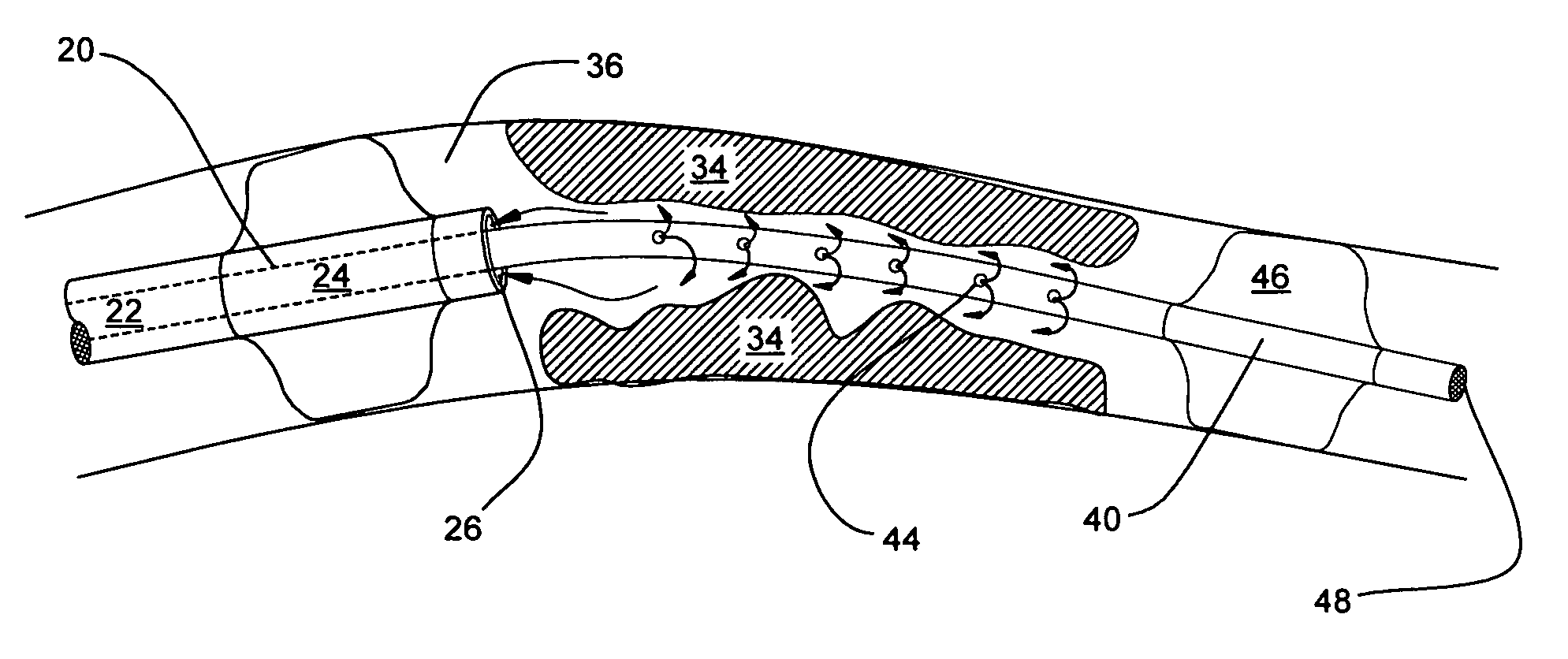 Catheter systems and methods for their use in the treatment of calcified vascular occlusions