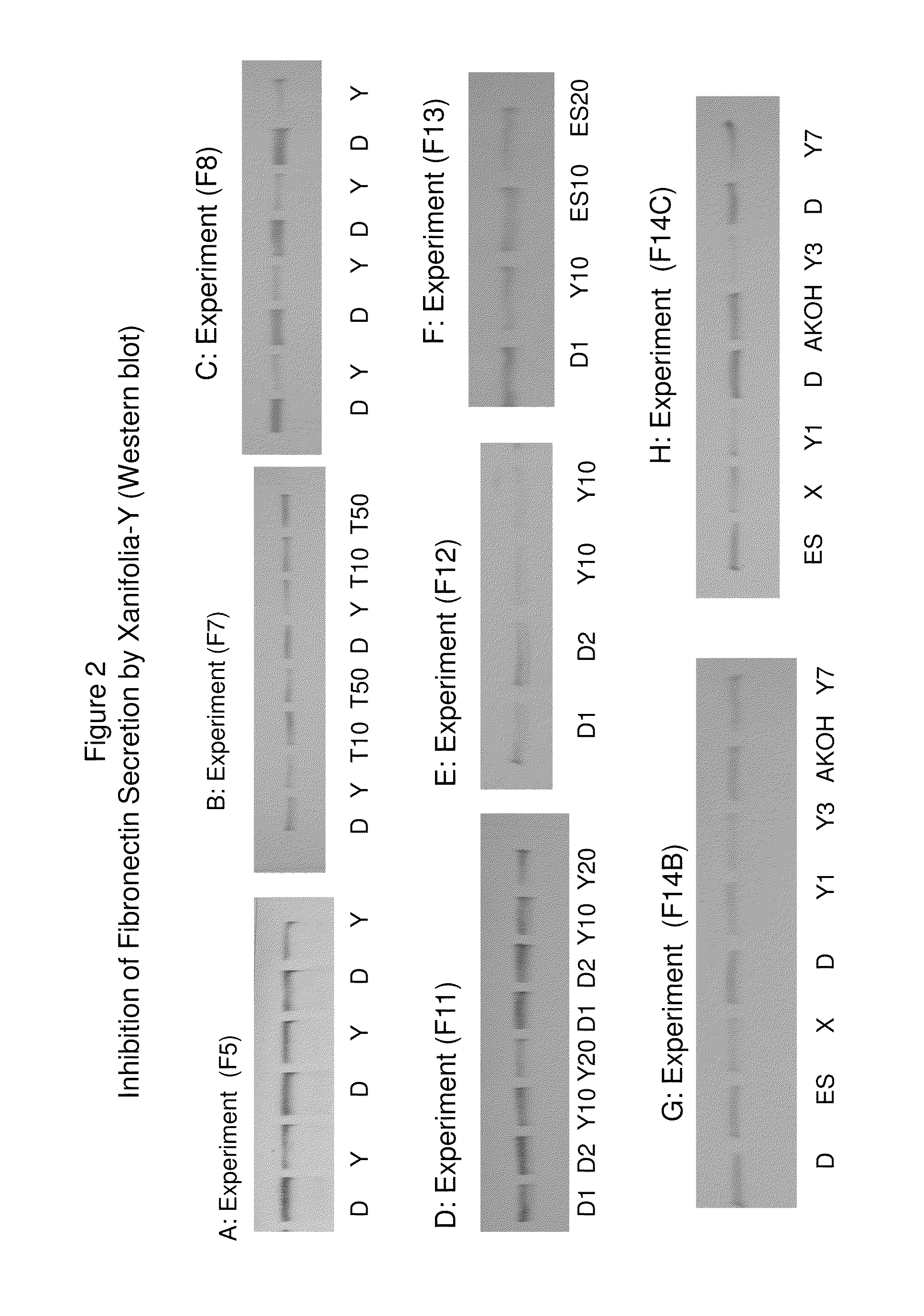 Blocking the migration or metastasis of cancer cells by affecting adhesion proteins and the uses of new compounds thereof