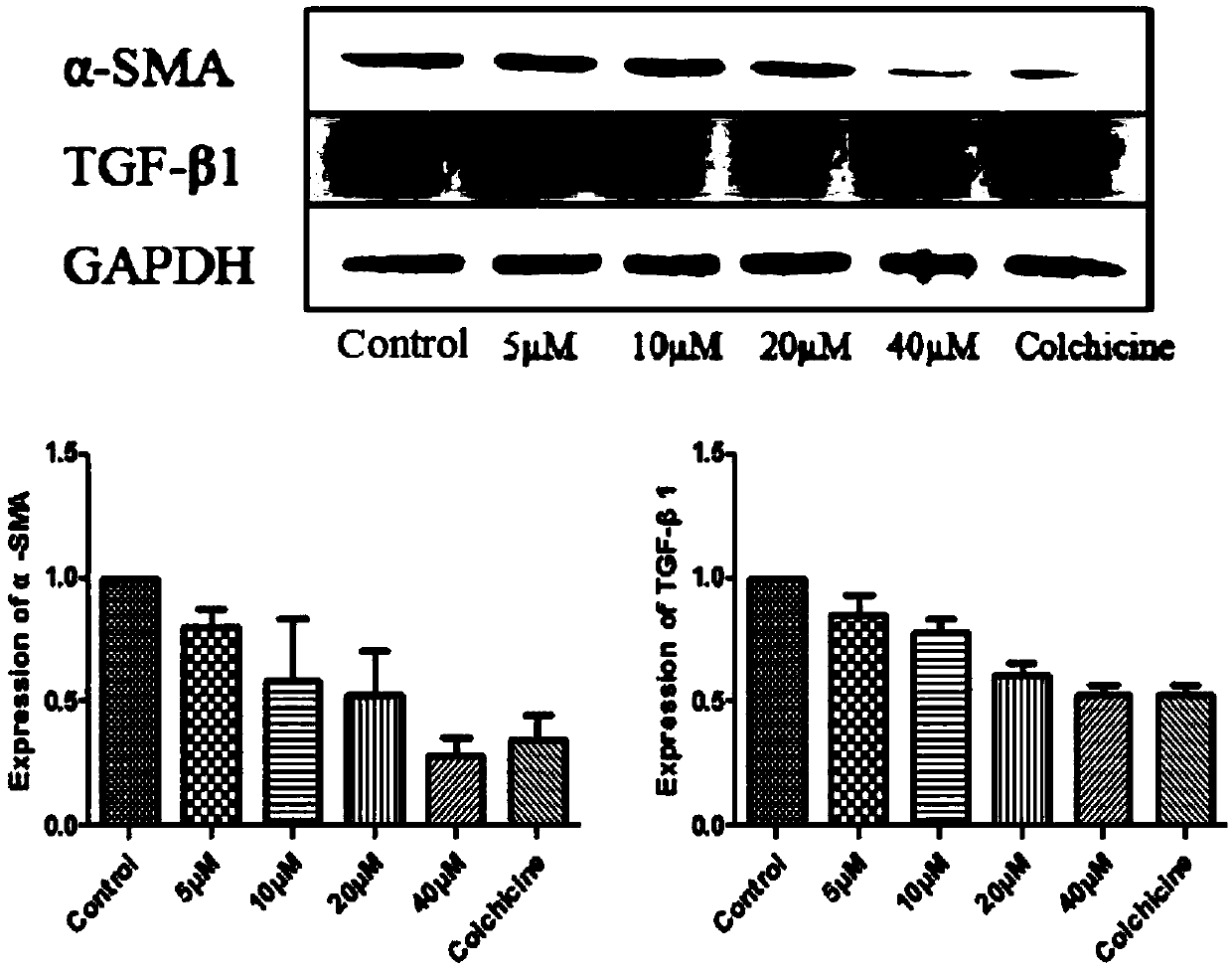 Application of thiazolopyranone analogues in preparation of anti-liver fibrosis or anti-acute liver injury medicines