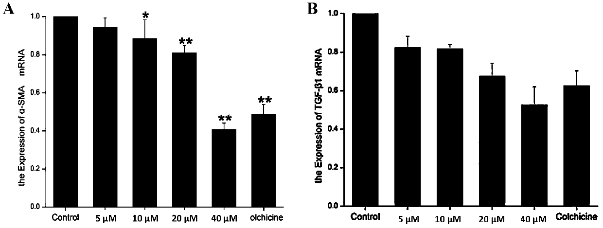 Application of thiazolopyranone analogues in preparation of anti-liver fibrosis or anti-acute liver injury medicines