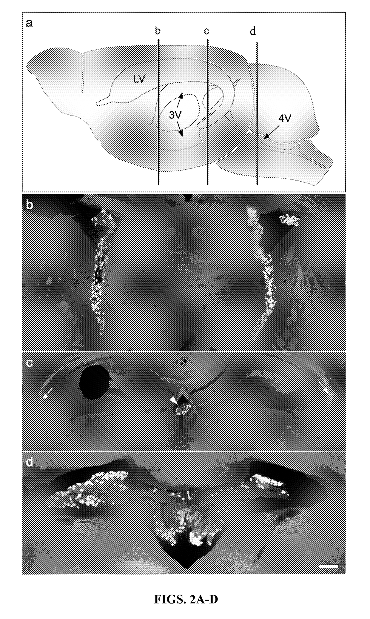 Engineered receptor/ligand system for delivery of therapeutic agents