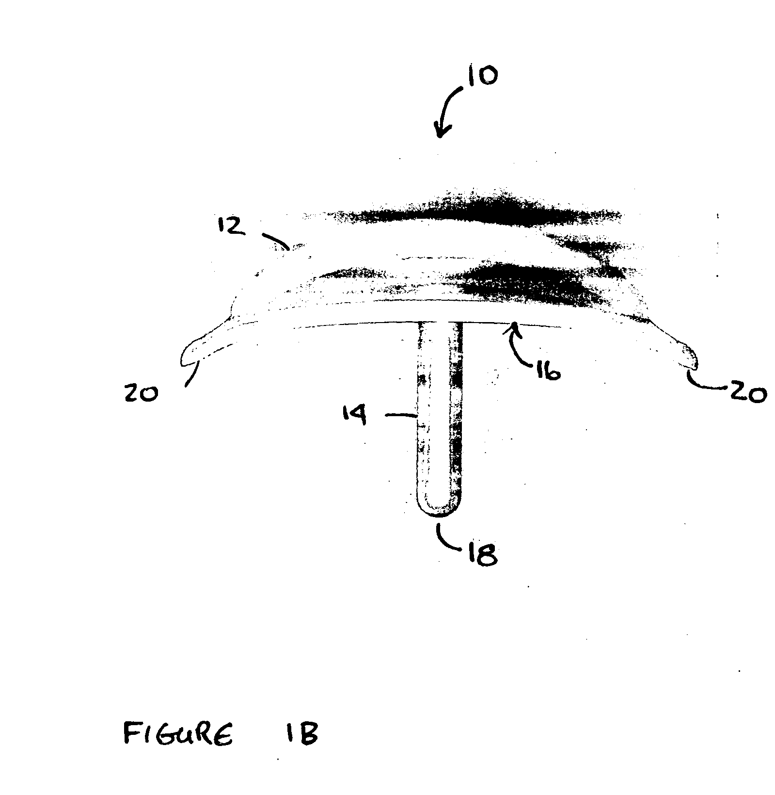 Pharmaceutical delivery device and method for providing ocular treatment