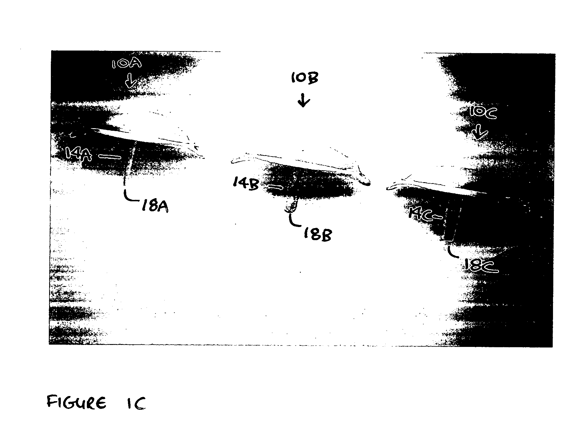 Pharmaceutical delivery device and method for providing ocular treatment