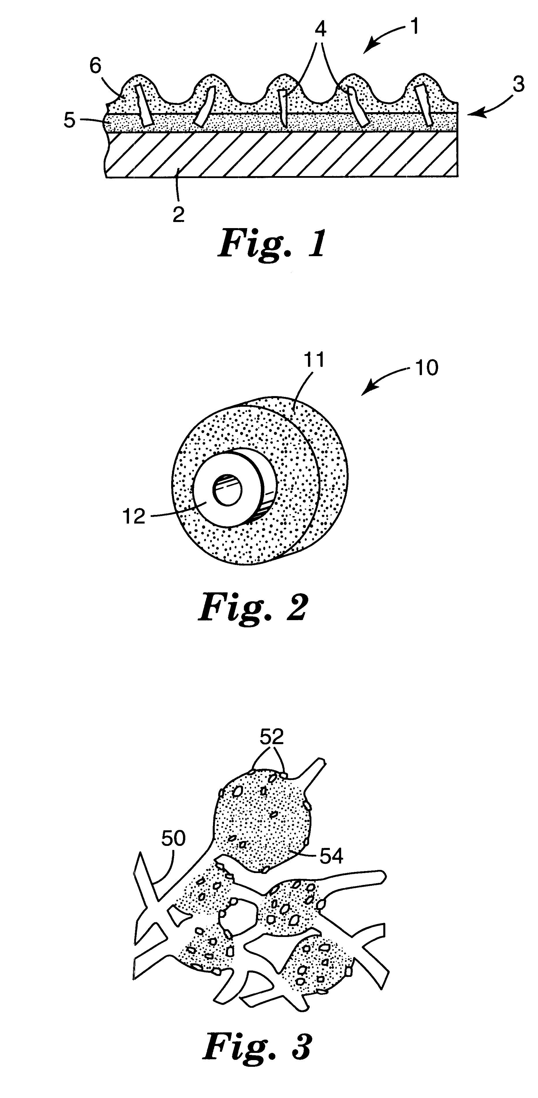 Fused aluminum oxycarbide/nitride-Al2O3 . rare earth oxide eutectic abrasive particles, abrasive articles, and methods of making and using the same