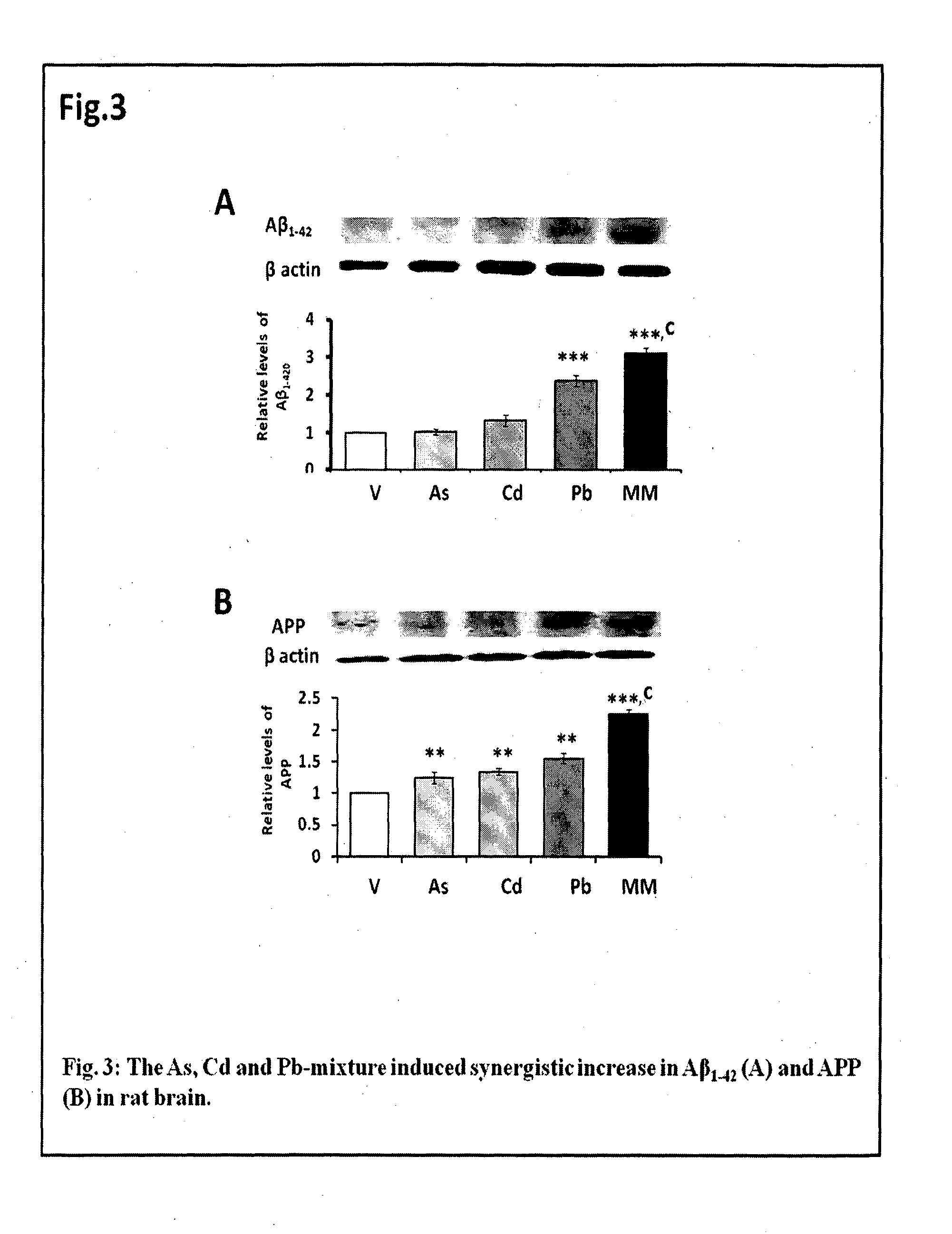 Model of alzheimer's disease