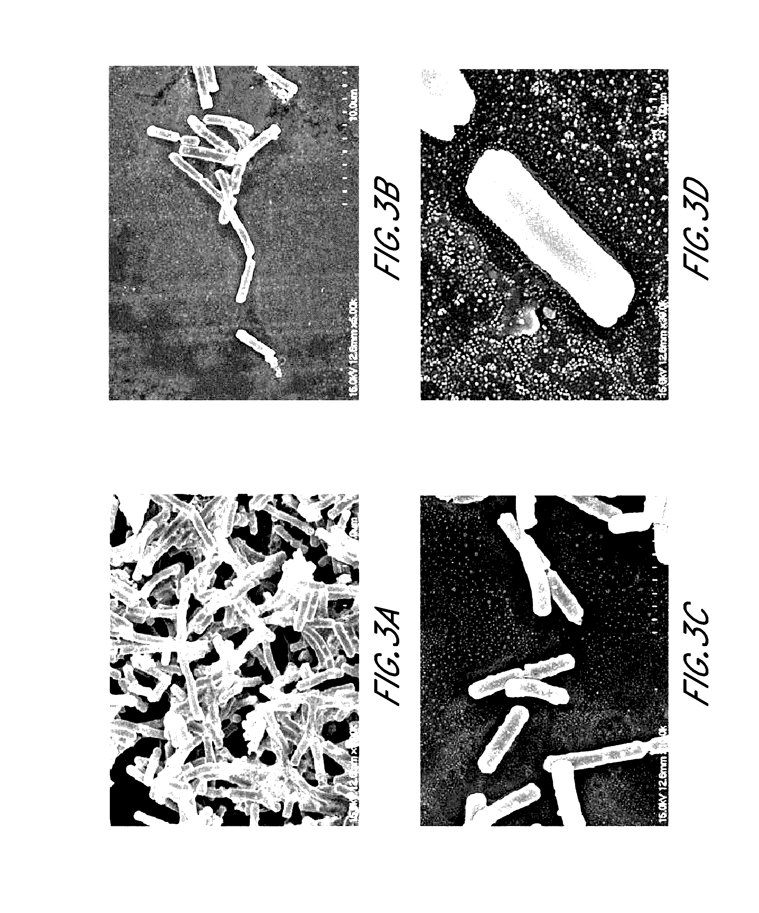 Lactobacillus crispatus and application thereof