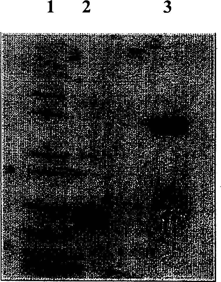 Method for preparing polyethylene glycol-modified alpha-interferon 1b