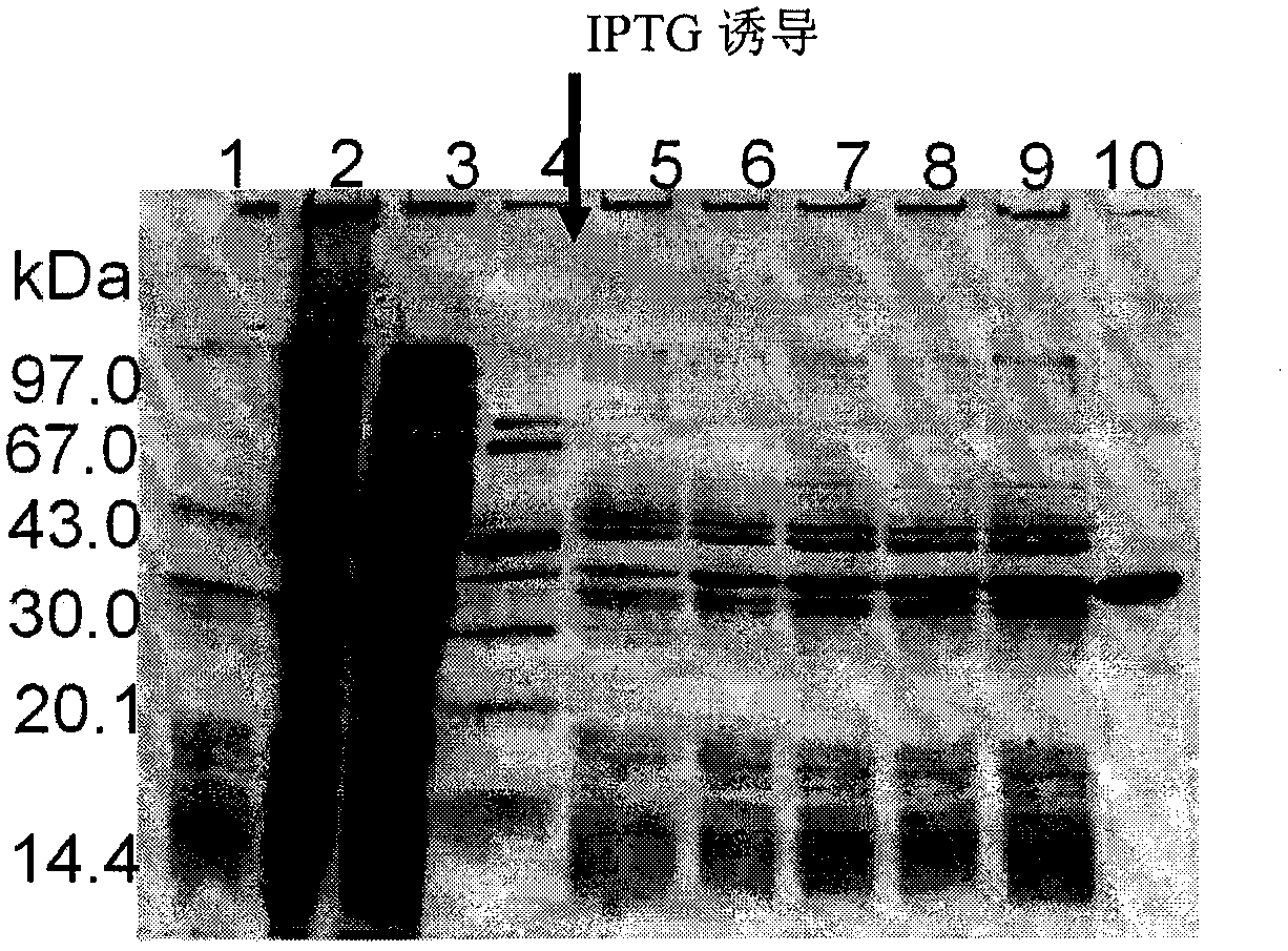 Recombinant human arginase fusion protein and application thereof